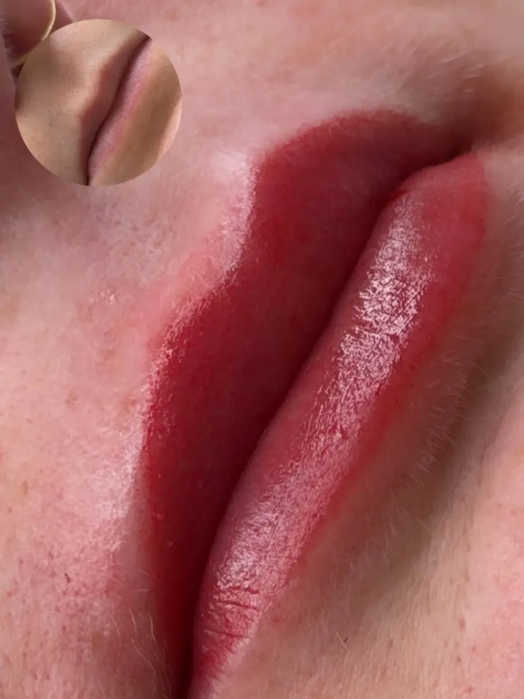 Lip blush efter behandling, med före-bild infälld