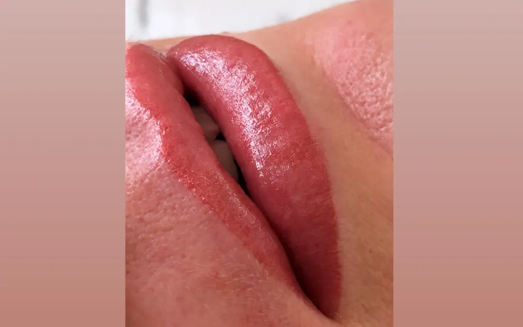 Läppar efter lip blush