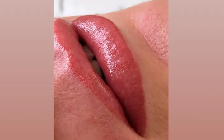 Läppar efter lip blush
